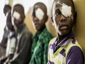 trachoma disease