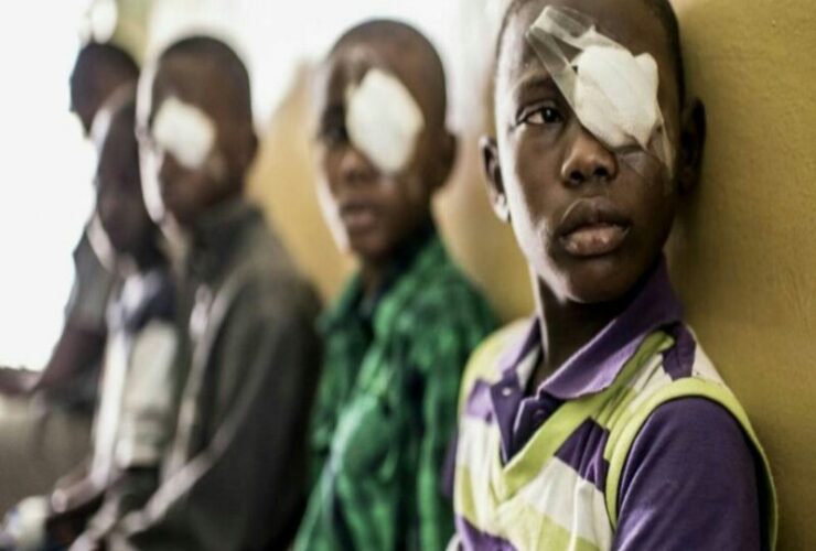 trachoma disease