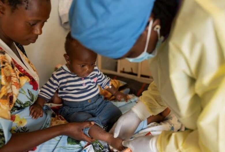 DR Congo to begin Mpox Vaccination