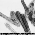 Rwanda confirms six deaths 20 cases in Marburg virus outbreak