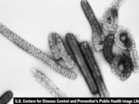 Rwanda confirms six deaths 20 cases in Marburg virus outbreak